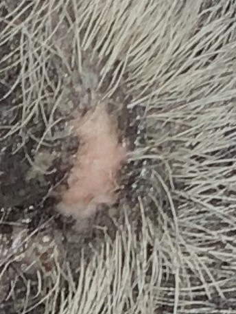 Sebaceous Adenoma After (4 Weeks)
