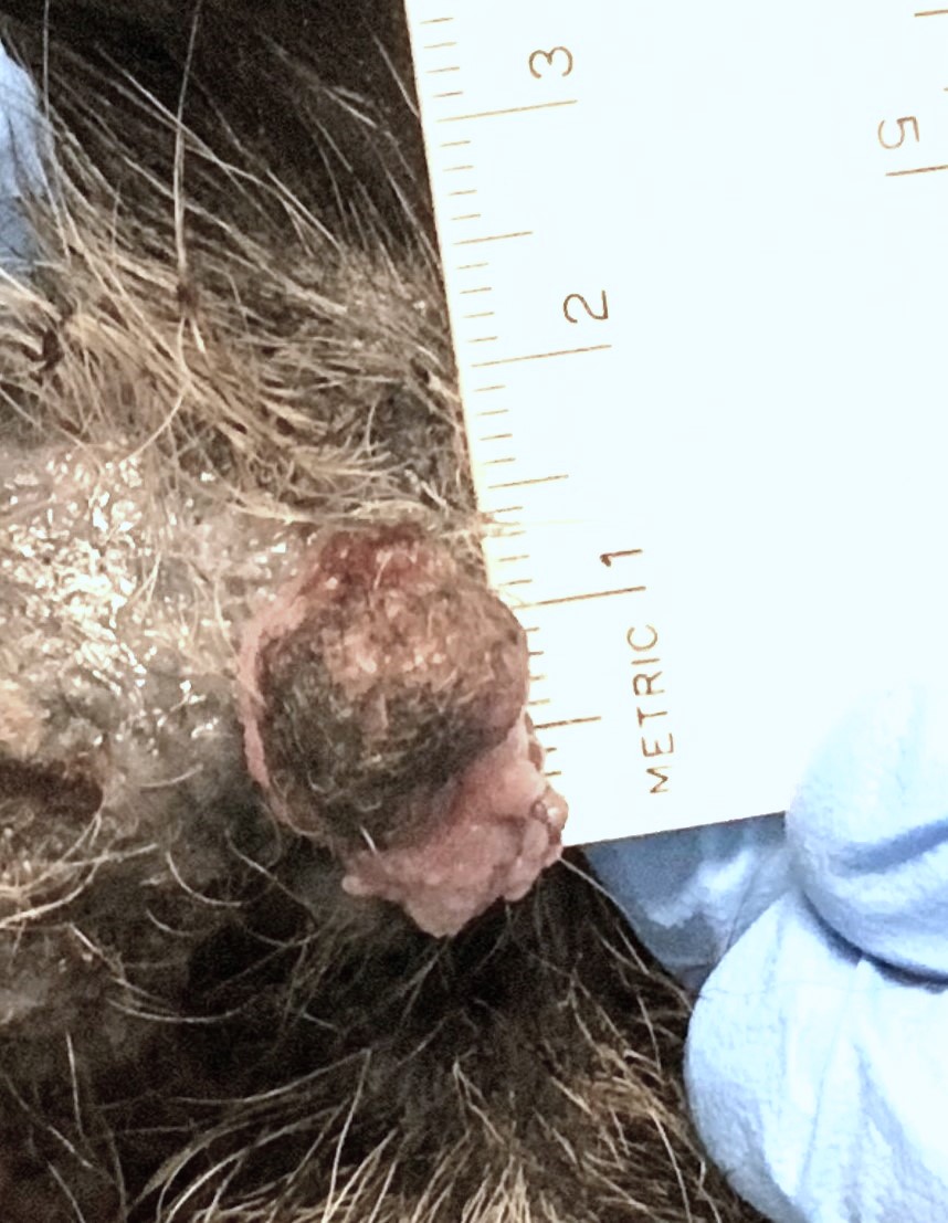 Sebaceous Adenoma Before