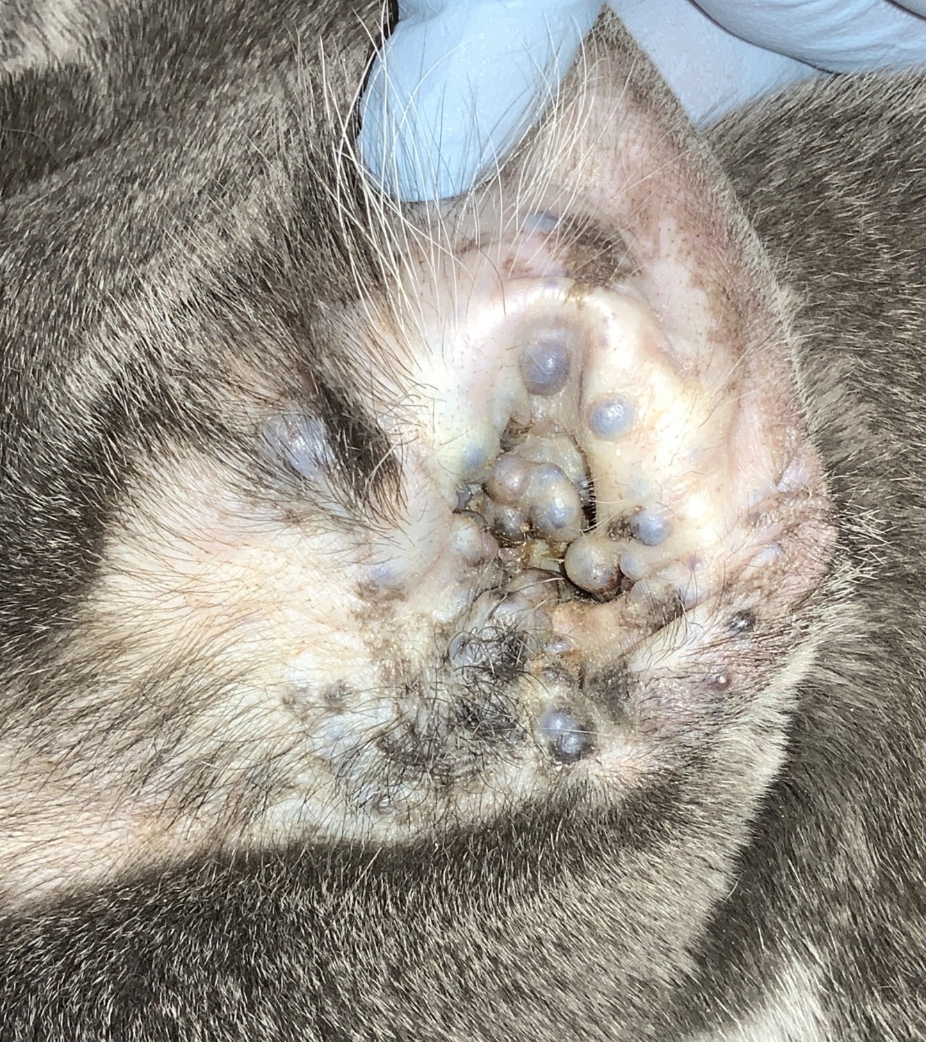 Apocrine Gland Cystadenoma Before